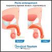 urology-penis-enlargement-1-before-after-medical-tourism.png‎