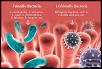 GutHealth_GoodBacteriavsBadPic.jpg‎